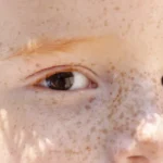 Reflexo branco nos olhos: entenda condição que assusta pais