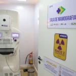 Lei garante mamografia pelo SUS para mulheres a partir dos 40 anos